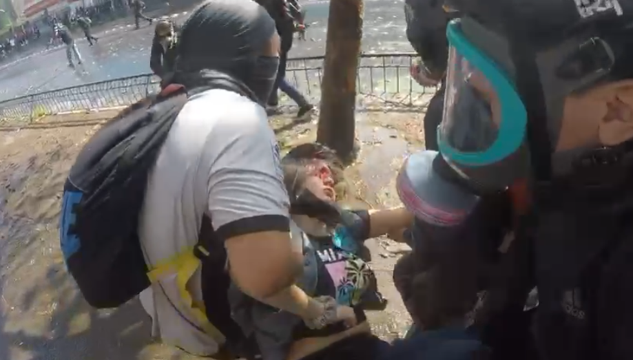 1° de Mayo Santiago: Reportera de «Señal 3 de La Victoria» herida a bala en el rostro